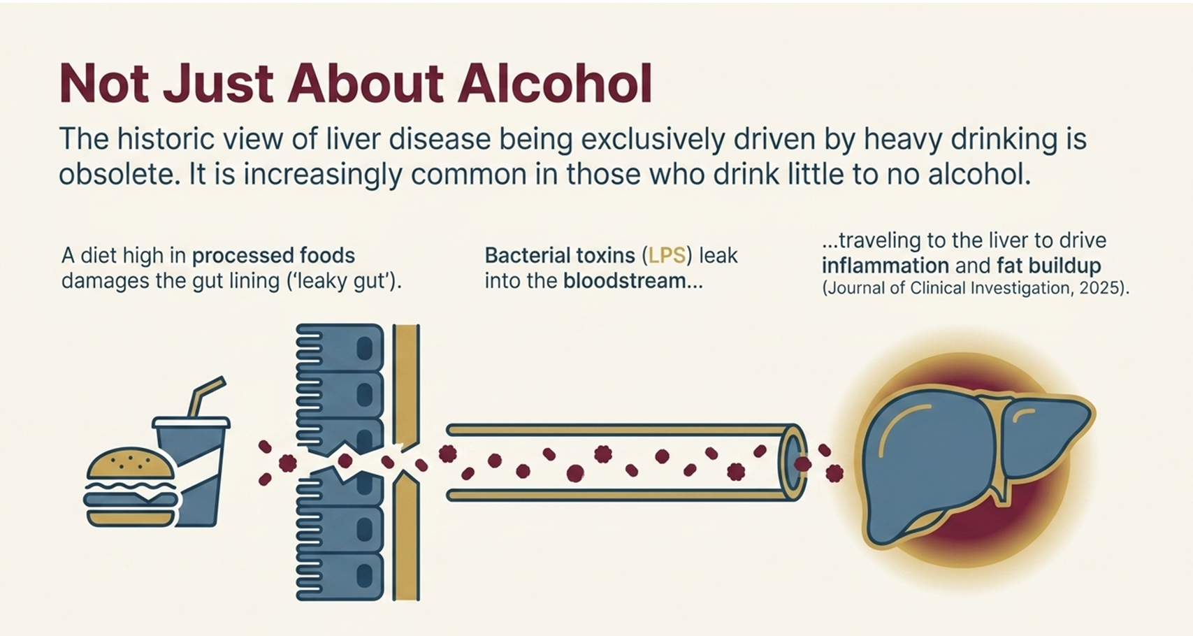 Fatty liver disease is not just about alcohol, the gut liver link