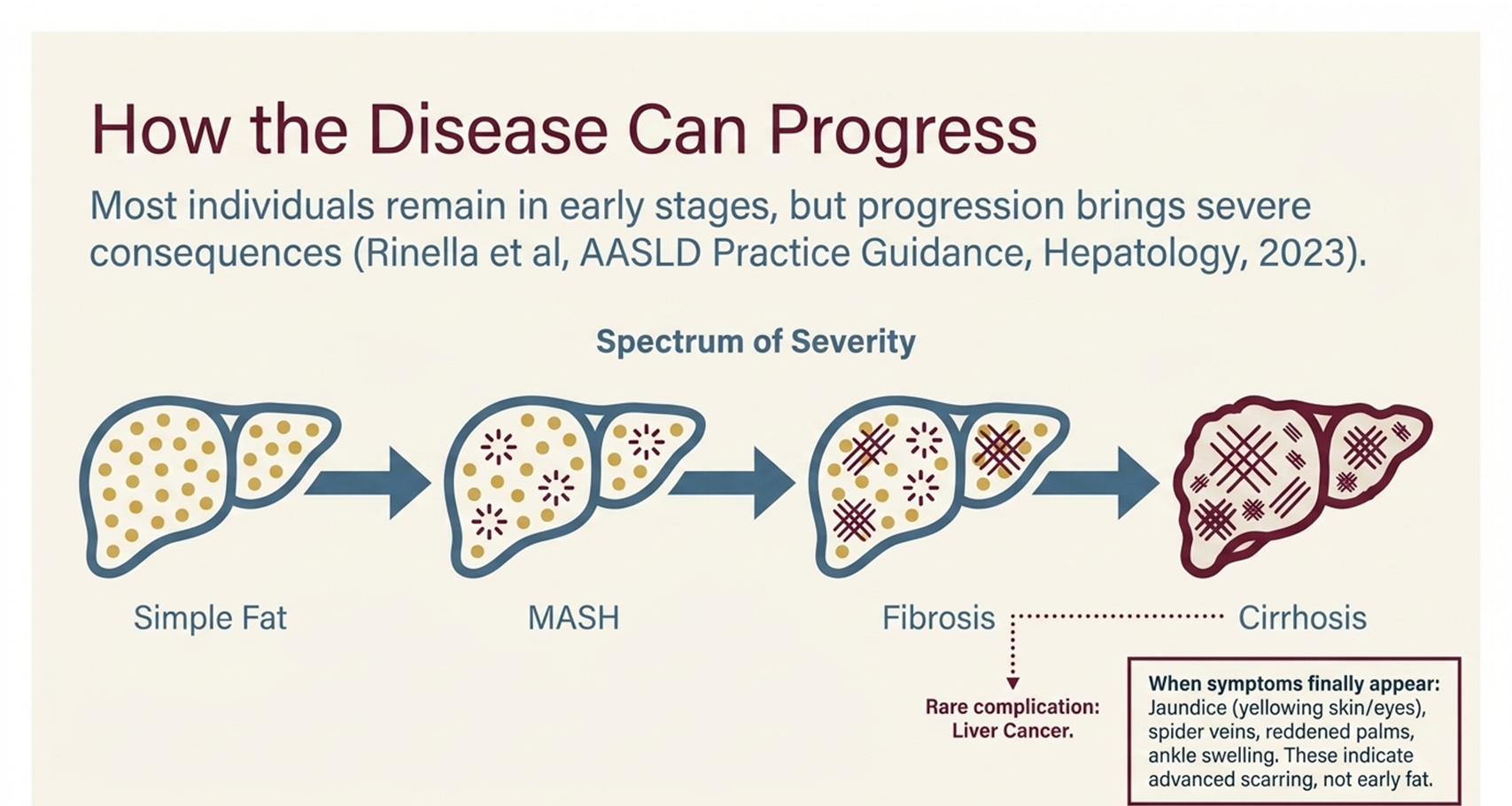 How fatty liver disease progresses from simple fat to cirrhosis