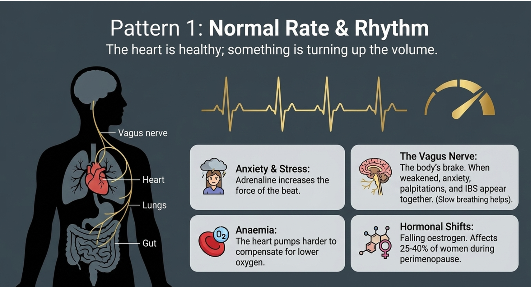 Causes of palpitations with normal rate and normal rhythm, anxiety and the vagus nerve